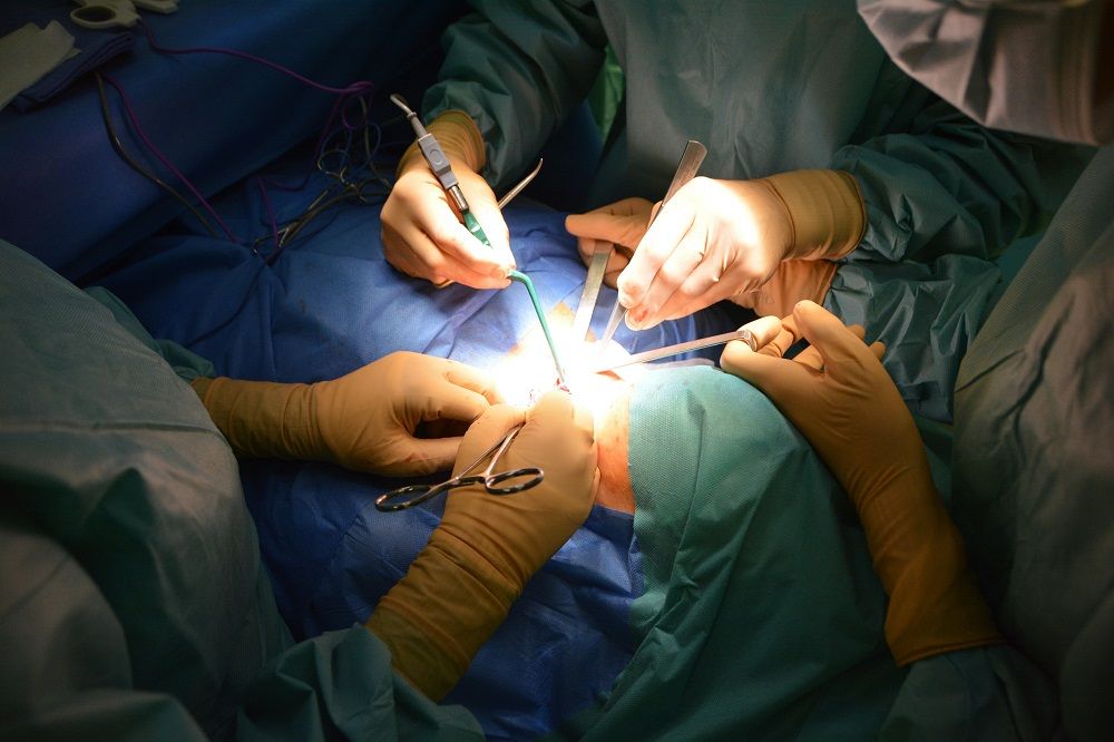 Ką svarbu žinoti prieš atliekant nosies operaciją?
